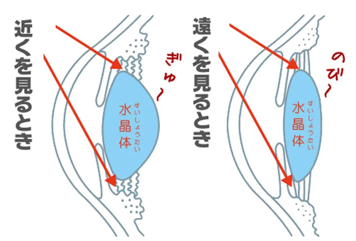 毛様体筋イメージ