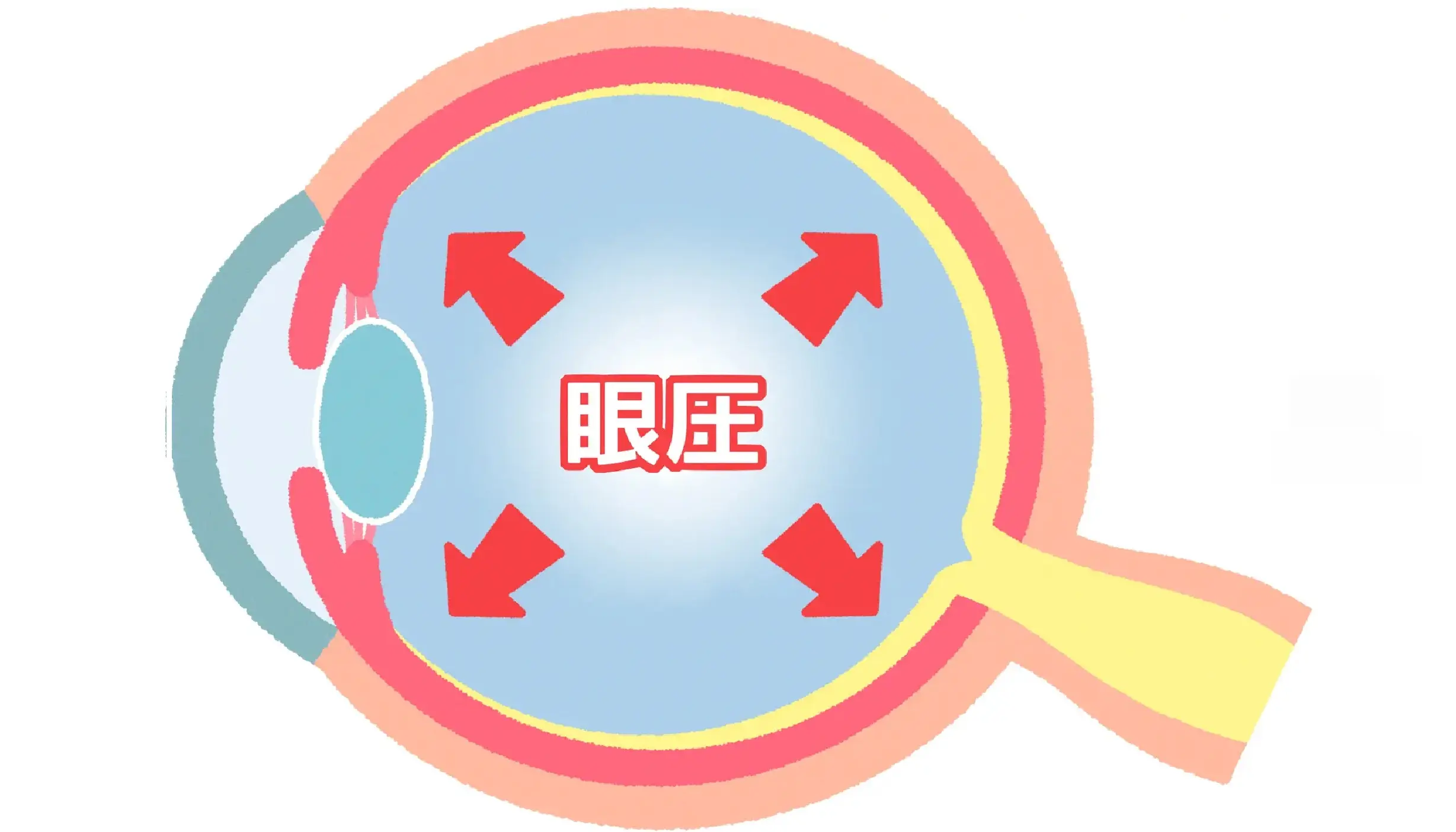 眼圧