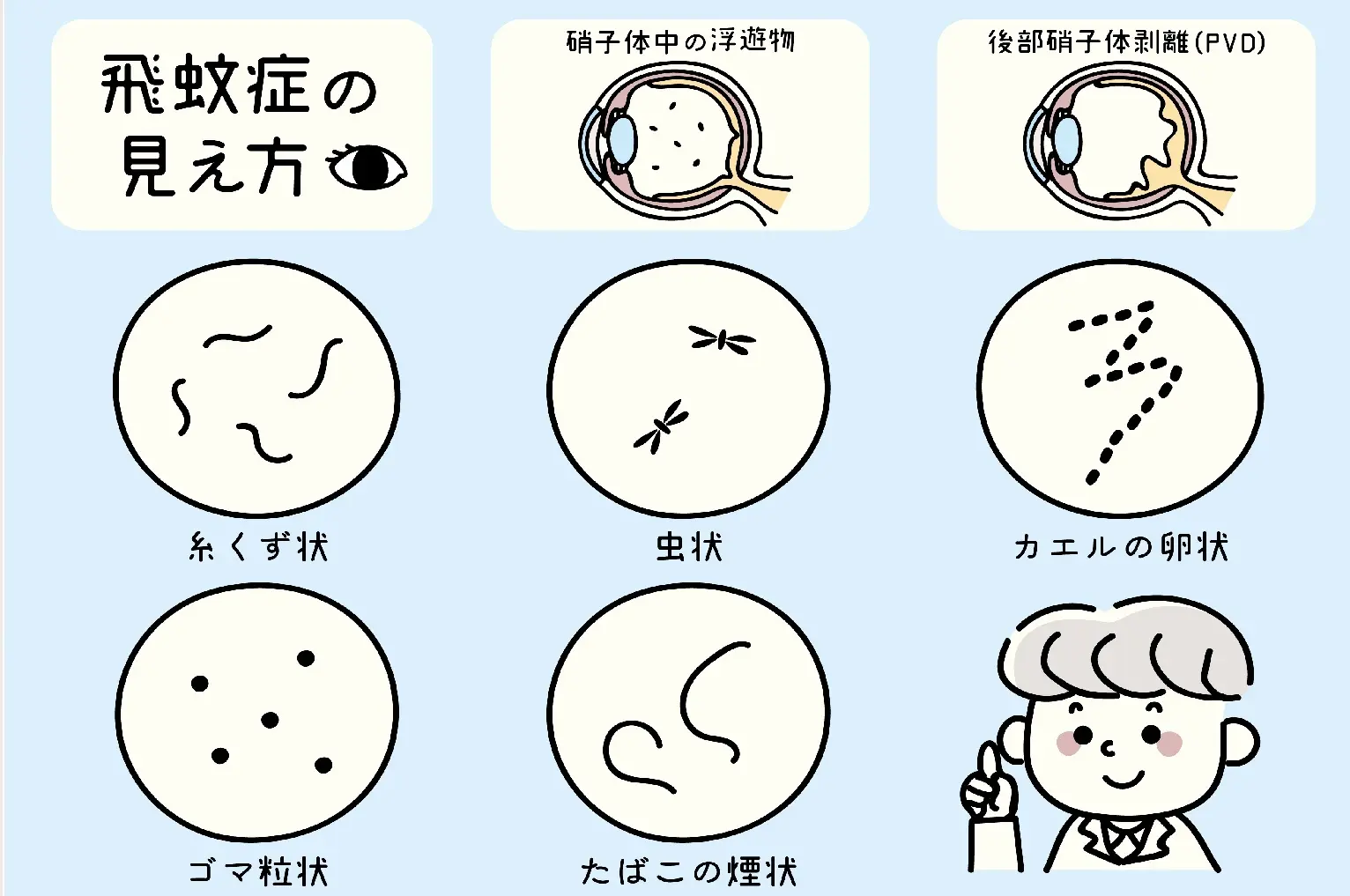 飛蚊症